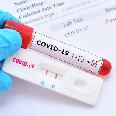 Экспресс-тест для выявления COVID-19