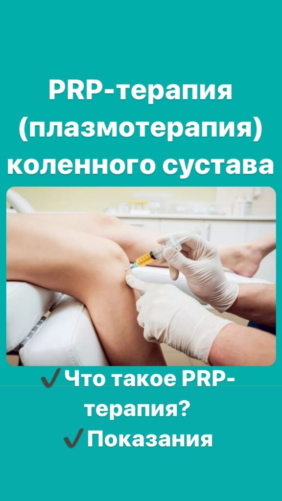 PRP-терапия (плазмотерапия) коленного сустава